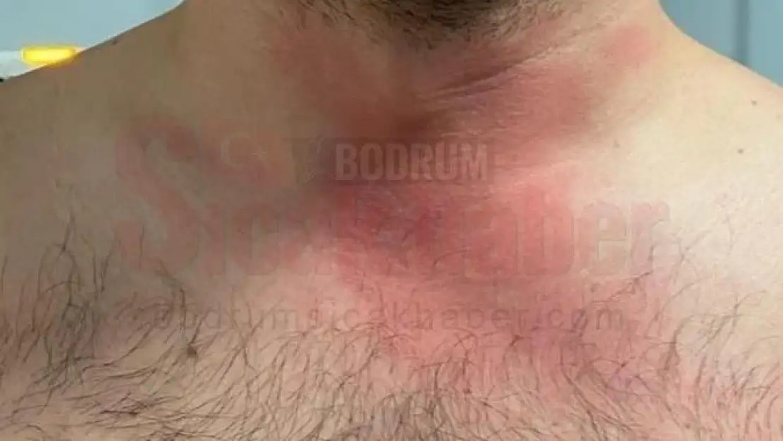 Hastanede Darp Edilen Doktorun Şikayetçi Olduğu A.A  Hakkında adli İşlem Başlatıldı