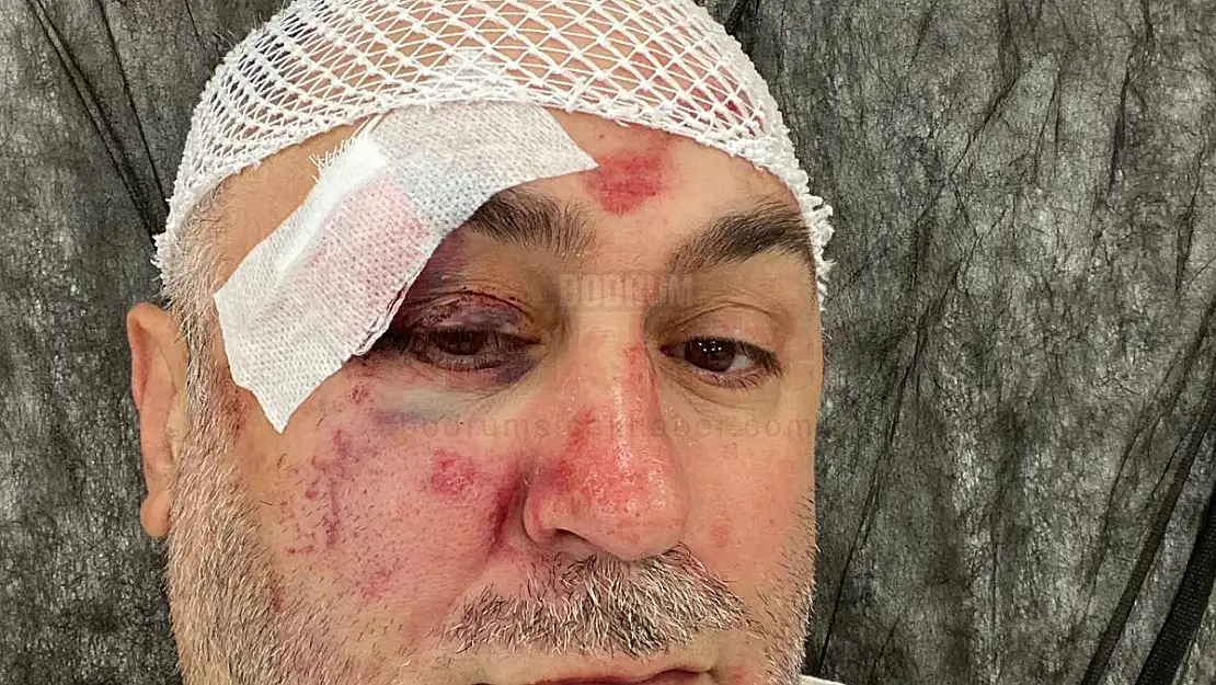 İşletmecisi Levent Bulut, Demir Çubukla Öldüresiye Darp Edilerek Parası Gasp edildi