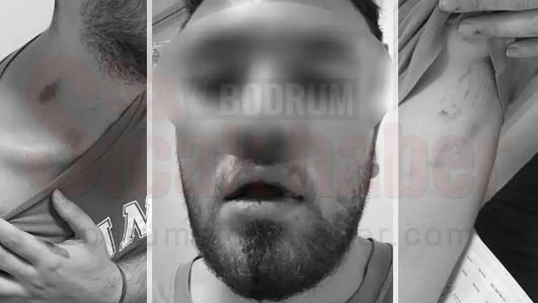Tıp Fakültesi Öğrencilerine Emlakçıdan Darp ve Tehdit İddiası