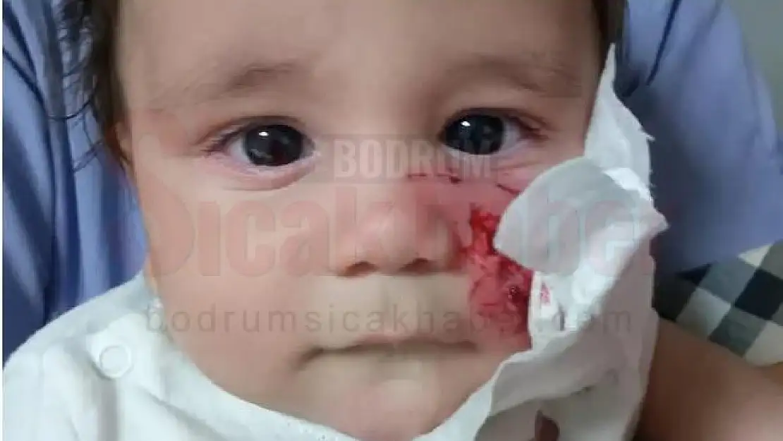 Yörük Kültür Şenliğin'de Bir Bebek Midilli Tarafından Isırıldı