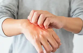 Gıda tüketiminde alerji ve zehirlenme endişesi