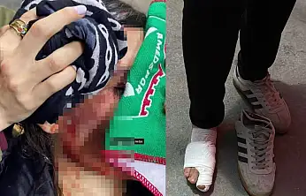 Spor alanlarında cinsiyetçi şiddete tepki