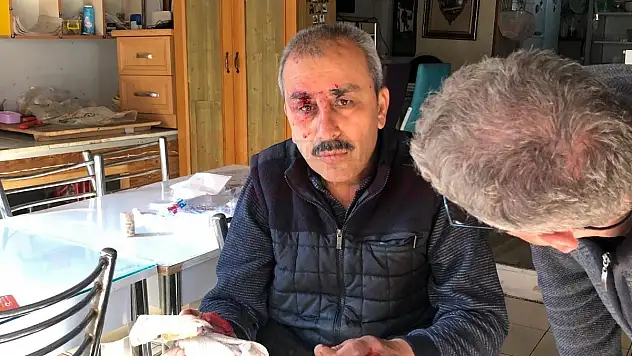 ALEV ALAN AKÜDEN BİR KİŞİ YARALANDI