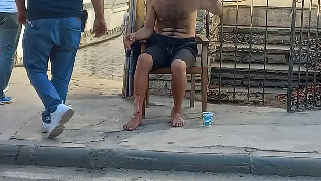 Çıkan Yangını Söndürmeye Çalışırken Yaralandı