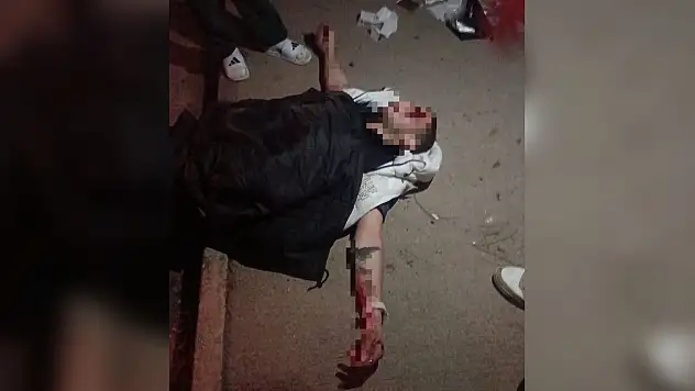 Domuza çarpmamak için kaza yaptı