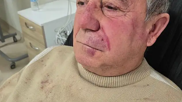 Ev Sahibinin Oğlu Tarafından Darp Edildi