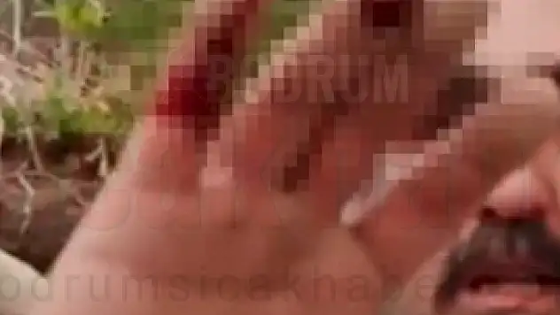 Evsahibi Kiracısının Parmağını Isırdı