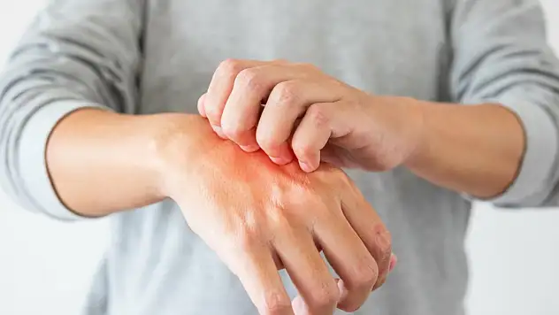 Gıda tüketiminde alerji ve zehirlenme endişesi