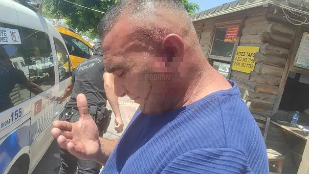 Otelden Kovdu Üstüne Hırsını Alamayıp Dövdü