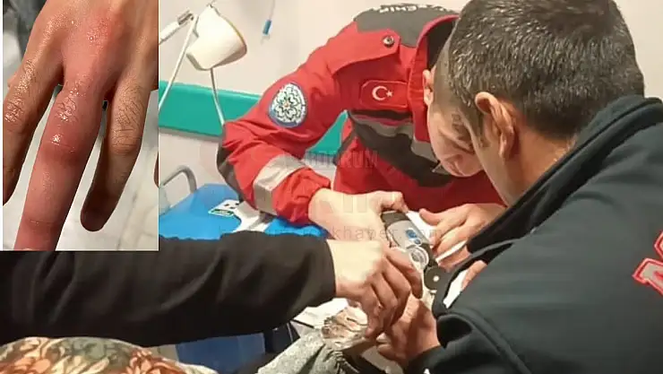 Genç Kız Parmağında Sıkışan Yüzükten Kurtarıldı