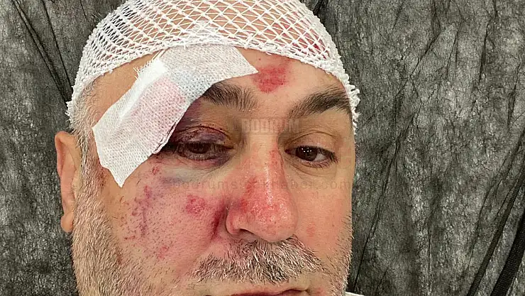 İşletmecisi Levent Bulut, Demir Çubukla Öldüresiye Darp Edilerek Parası Gasp edildi