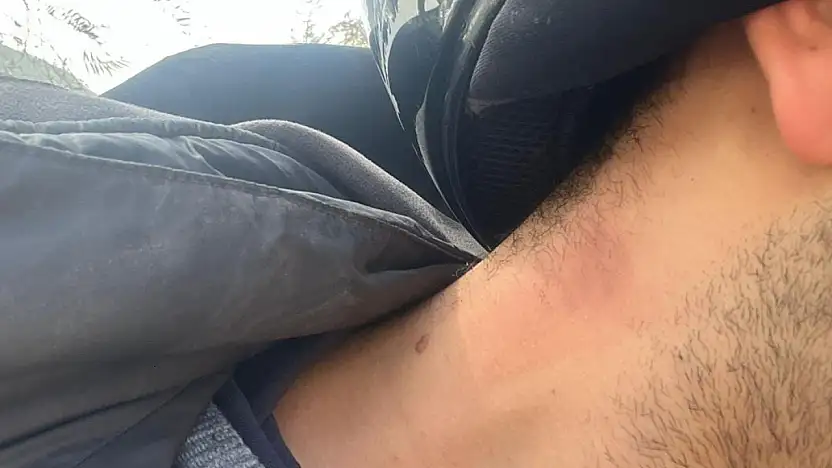 Kopan elektrik teli motosiklet sürücüsünü yaraladı