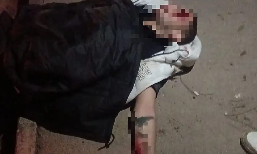 Domuza çarpmamak için kaza yaptı